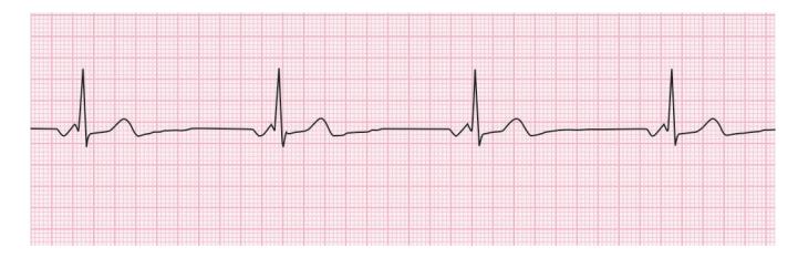 images/VVK-P-Osce 15. Cardiovascular System_page_3_Figure_5.jpeg