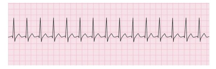 images/VVK-P-Osce 15. Cardiovascular System_page_3_Figure_7.jpeg