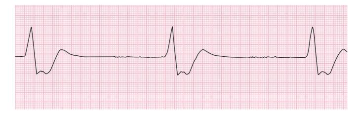 images/VVK-P-Osce 15. Cardiovascular System_page_3_Figure_9.jpeg