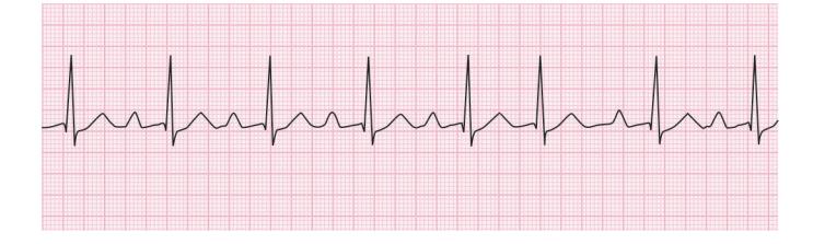 images/VVK-P-Osce 15. Cardiovascular System_page_4_Figure_11.jpeg