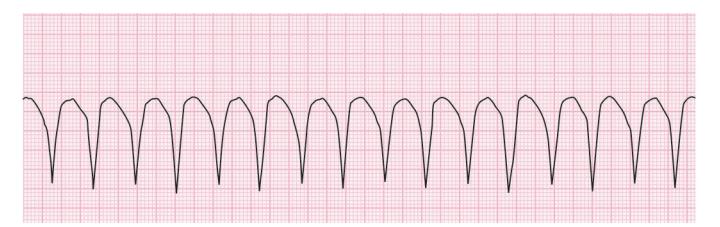 images/VVK-P-Osce 15. Cardiovascular System_page_4_Figure_3.jpeg
