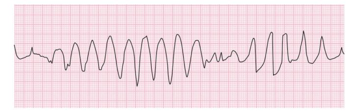 images/VVK-P-Osce 15. Cardiovascular System_page_4_Figure_5.jpeg