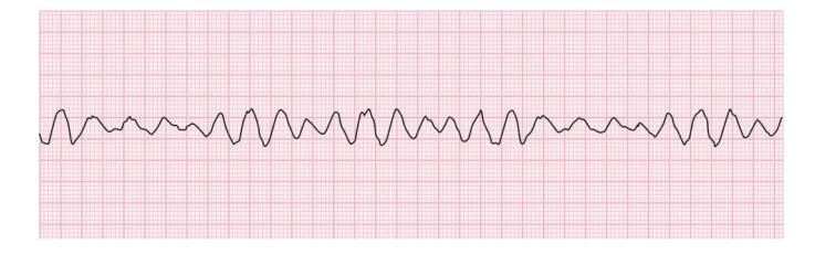 images/VVK-P-Osce 15. Cardiovascular System_page_4_Figure_7.jpeg