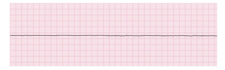 images/VVK-P-Osce 15. Cardiovascular System_page_4_Figure_9.jpeg