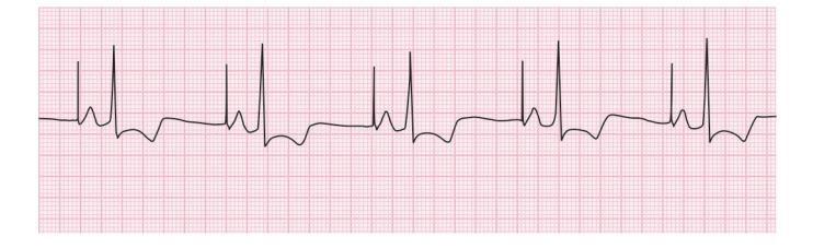 images/VVK-P-Osce 15. Cardiovascular System_page_5_Figure_11.jpeg