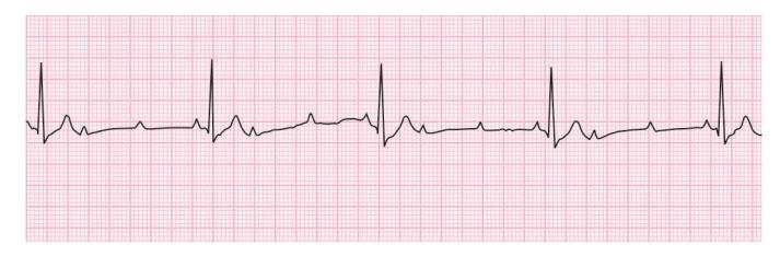images/VVK-P-Osce 15. Cardiovascular System_page_5_Figure_3.jpeg