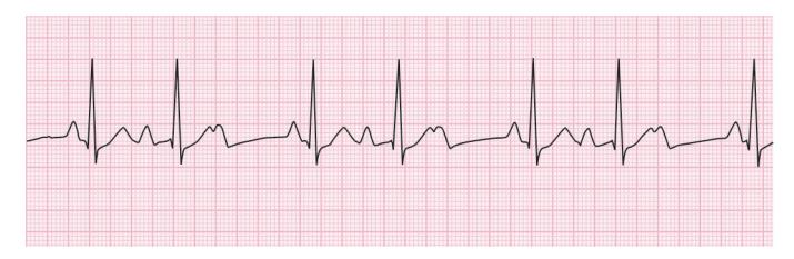 images/VVK-P-Osce 15. Cardiovascular System_page_5_Figure_5.jpeg