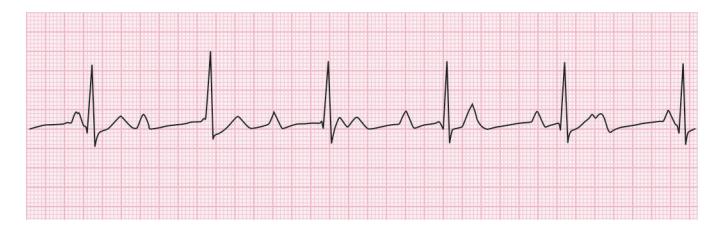 images/VVK-P-Osce 15. Cardiovascular System_page_5_Figure_7.jpeg