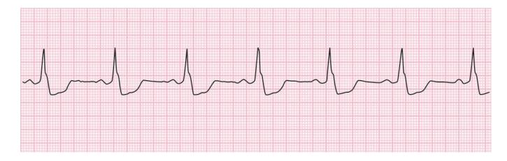 images/VVK-P-Osce 15. Cardiovascular System_page_5_Figure_9.jpeg