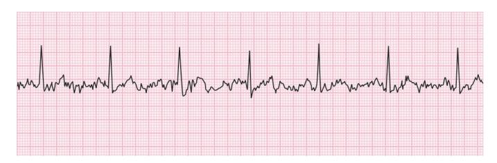 images/VVK-P-Osce 15. Cardiovascular System_page_6_Figure_5.jpeg