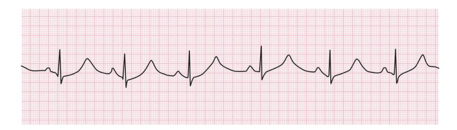 images/VVK-P-Osce 15. Cardiovascular System_page_6_Figure_7.jpeg