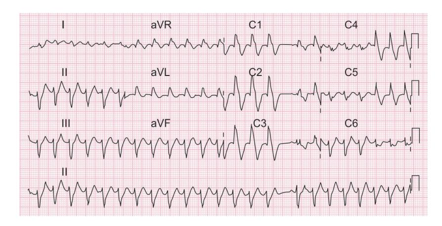 images/VVK-P-Osce 15. Cardiovascular System_page_7_Figure_6.jpeg