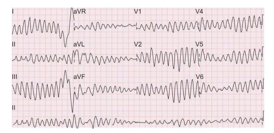 images/VVK-P-Osce 15. Cardiovascular System_page_8_Figure_10.jpeg