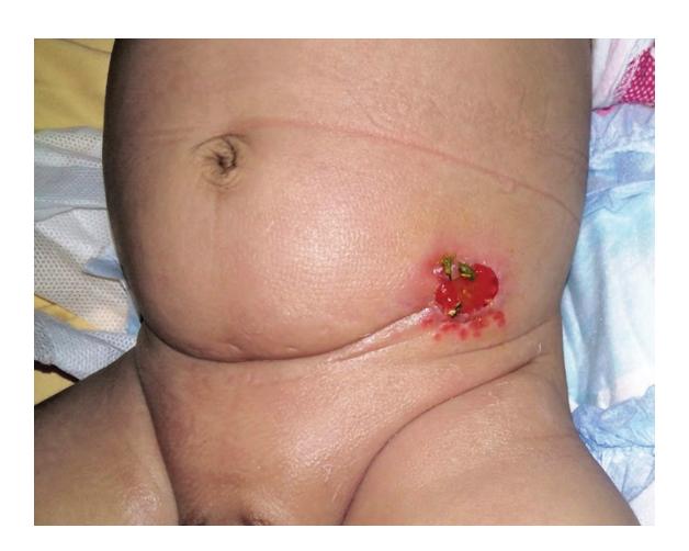 images/VVK-P-Osce 17. Neonatology_page_0_Picture_5.jpeg