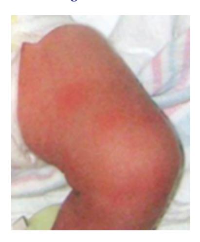 images/VVK-P-Osce 17. Neonatology_page_10_Picture_3.jpeg
