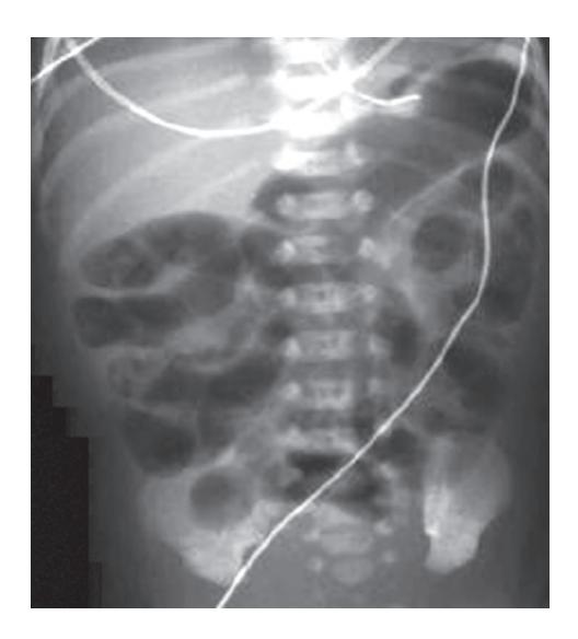 images/VVK-P-Osce 17. Neonatology_page_10_Picture_8.jpeg