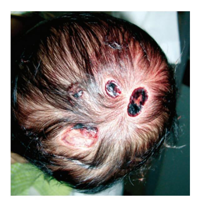 images/VVK-P-Osce 17. Neonatology_page_11_Picture_17.jpeg