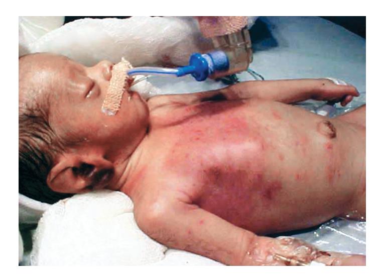 images/VVK-P-Osce 17. Neonatology_page_12_Picture_3.jpeg