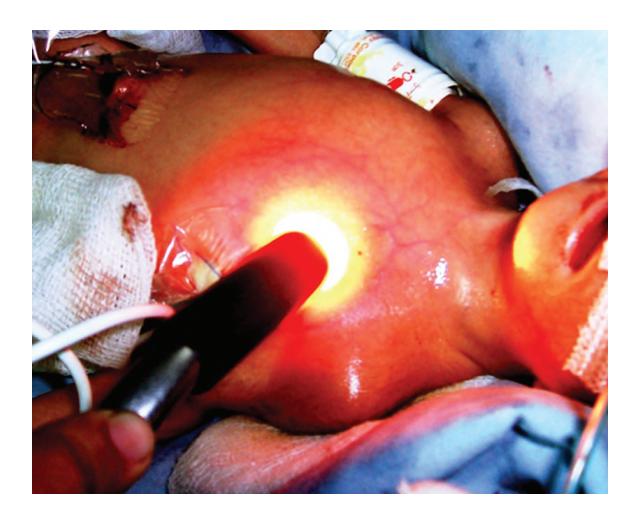 images/VVK-P-Osce 17. Neonatology_page_12_Picture_8.jpeg