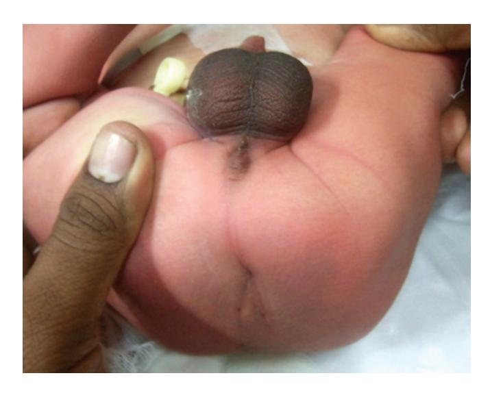 images/VVK-P-Osce 17. Neonatology_page_13_Picture_3.jpeg