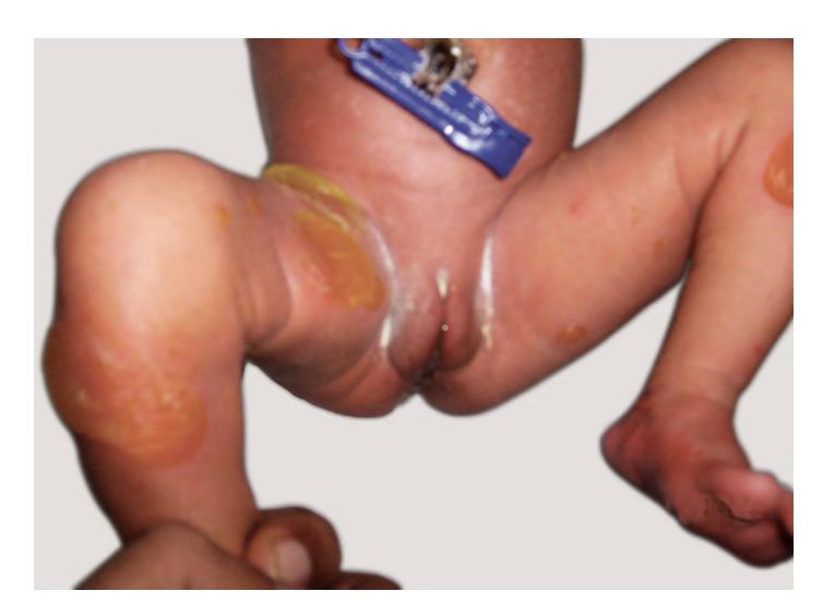 images/VVK-P-Osce 17. Neonatology_page_13_Picture_9.jpeg