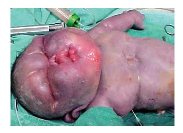 images/VVK-P-Osce 17. Neonatology_page_14_Picture_3.jpeg