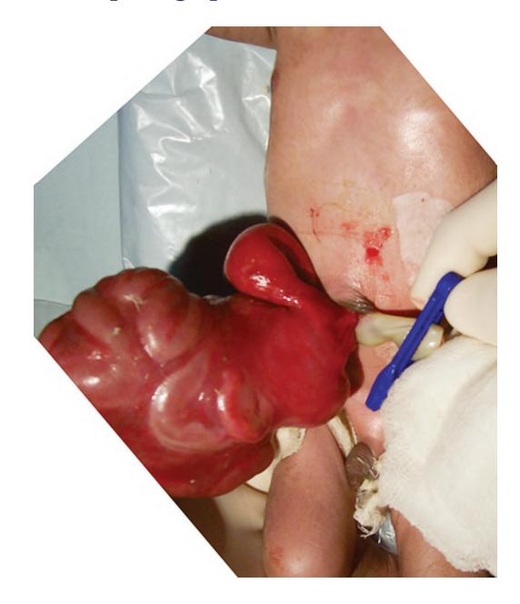 images/VVK-P-Osce 17. Neonatology_page_14_Picture_8.jpeg