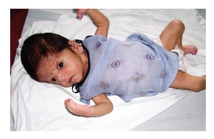 images/VVK-P-Osce 17. Neonatology_page_15_Picture_3.jpeg