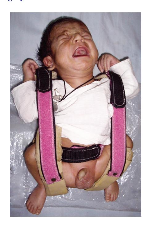 images/VVK-P-Osce 17. Neonatology_page_15_Picture_8.jpeg