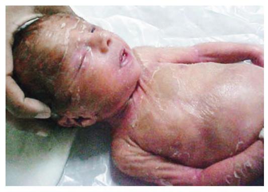 images/VVK-P-Osce 17. Neonatology_page_16_Picture_3.jpeg