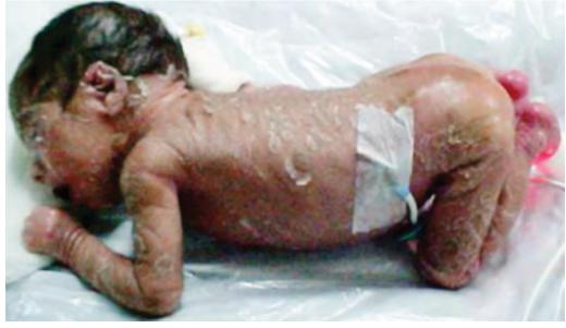 images/VVK-P-Osce 17. Neonatology_page_16_Picture_4.jpeg