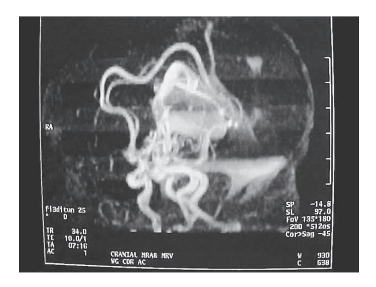 images/VVK-P-Osce 17. Neonatology_page_17_Figure_3.jpeg
