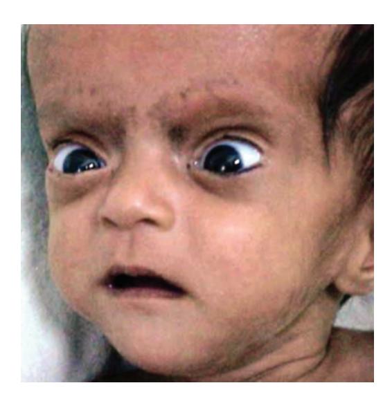 images/VVK-P-Osce 17. Neonatology_page_17_Picture_8.jpeg