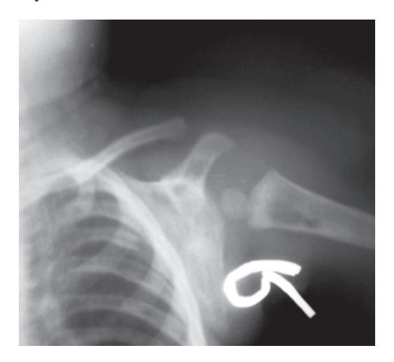 images/VVK-P-Osce 17. Neonatology_page_18_Picture_3.jpeg