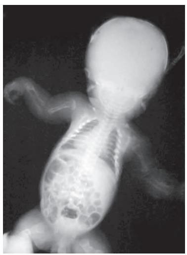 images/VVK-P-Osce 17. Neonatology_page_18_Picture_8.jpeg