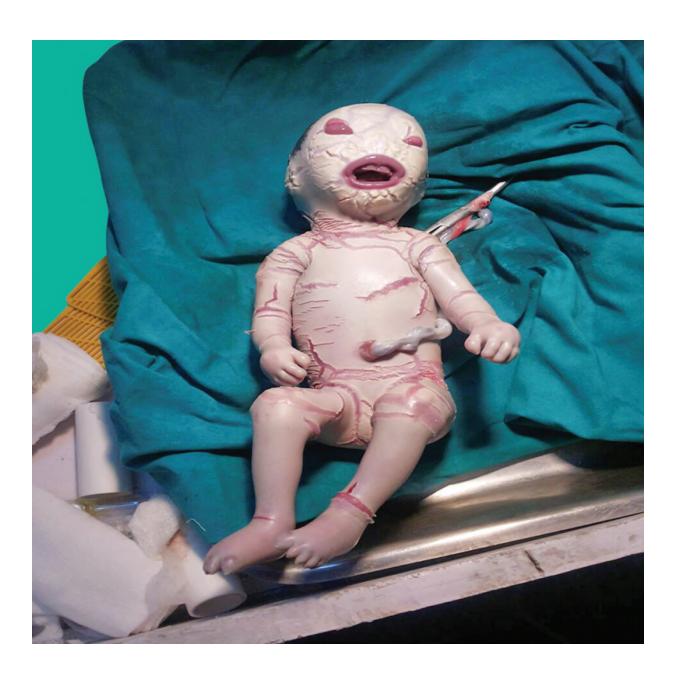 images/VVK-P-Osce 17. Neonatology_page_1_Picture_11.jpeg