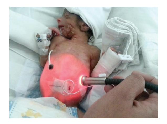 images/VVK-P-Osce 17. Neonatology_page_1_Picture_3.jpeg