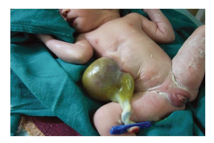 images/VVK-P-Osce 17. Neonatology_page_2_Picture_30.jpeg