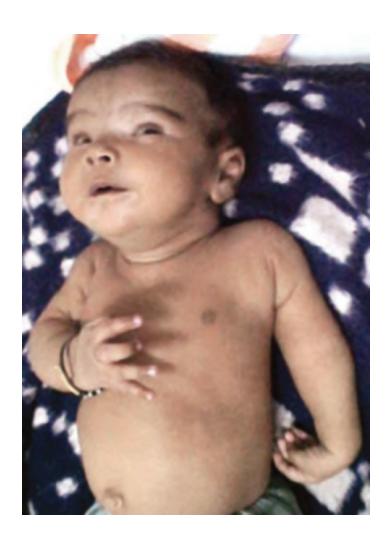 images/VVK-P-Osce 17. Neonatology_page_4_Picture_10.jpeg