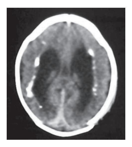 images/VVK-P-Osce 17. Neonatology_page_5_Picture_3.jpeg