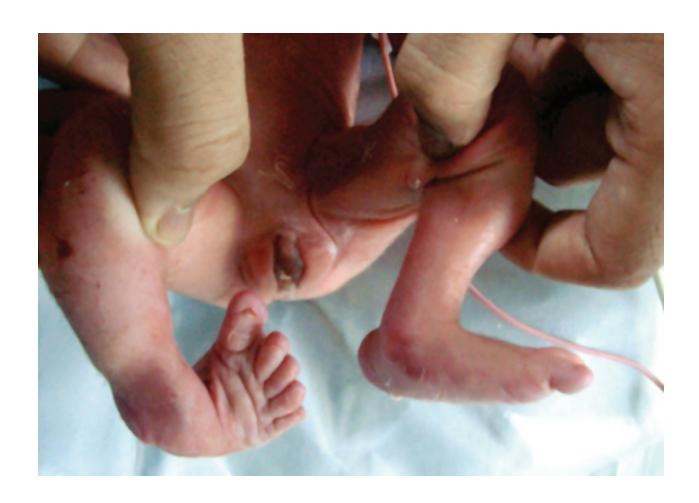 images/VVK-P-Osce 17. Neonatology_page_8_Picture_17.jpeg