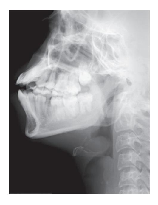 images/VVK-P-Osce 18. Radiology_page_10_Picture_7.jpeg