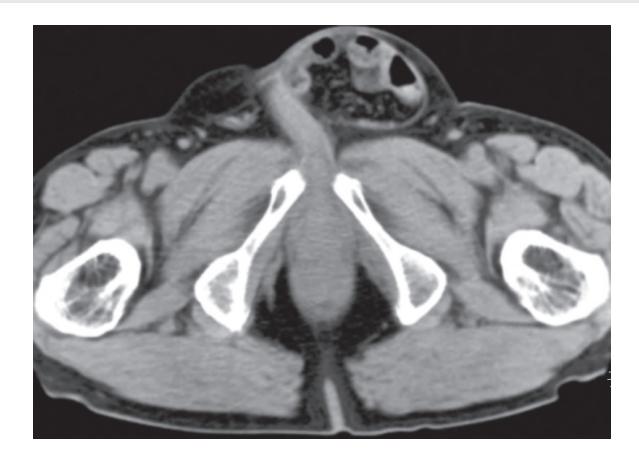 images/VVK-P-Osce 18. Radiology_page_11_Picture_2.jpeg