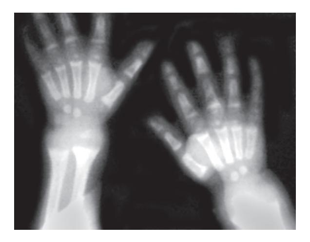 images/VVK-P-Osce 18. Radiology_page_11_Picture_6.jpeg