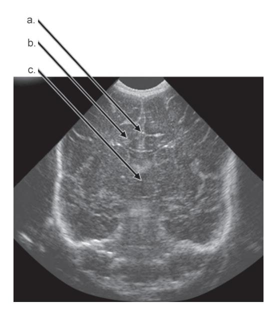 images/VVK-P-Osce 18. Radiology_page_12_Picture_3.jpeg