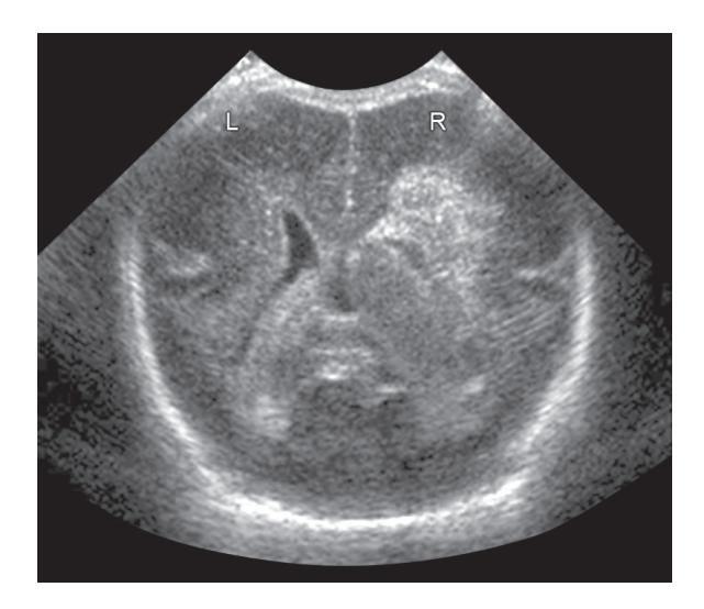 images/VVK-P-Osce 18. Radiology_page_12_Picture_5.jpeg