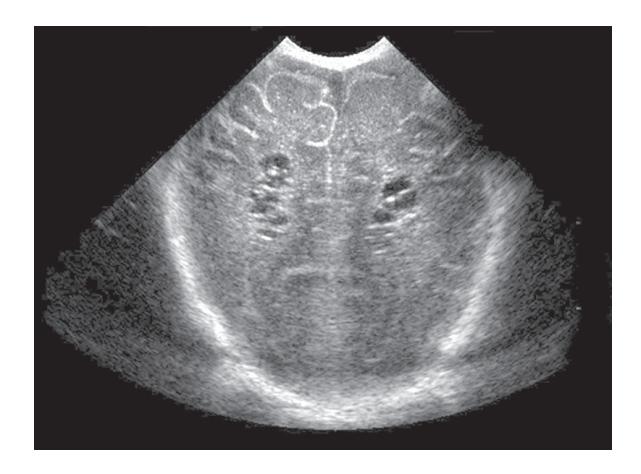 images/VVK-P-Osce 18. Radiology_page_13_Picture_3.jpeg