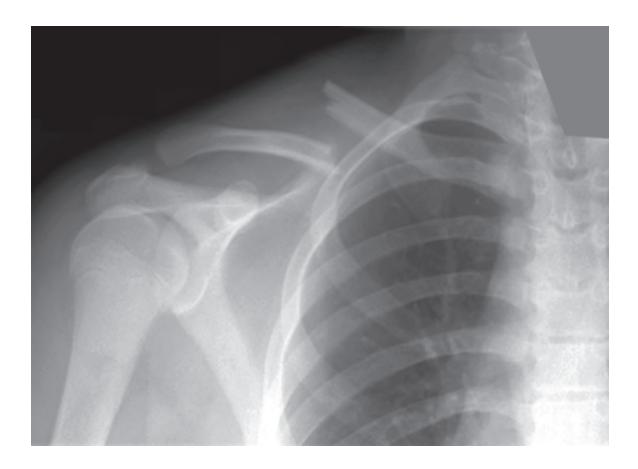 images/VVK-P-Osce 18. Radiology_page_13_Picture_8.jpeg