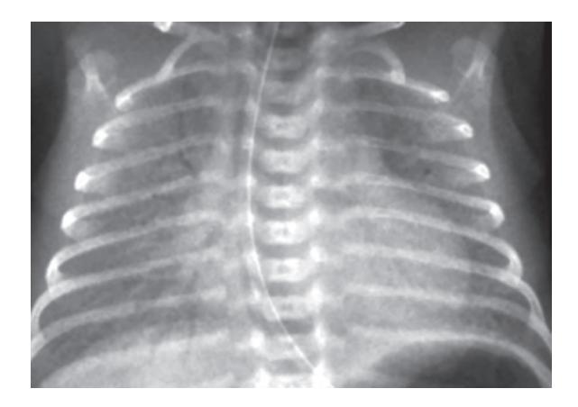 images/VVK-P-Osce 18. Radiology_page_14_Picture_3.jpeg