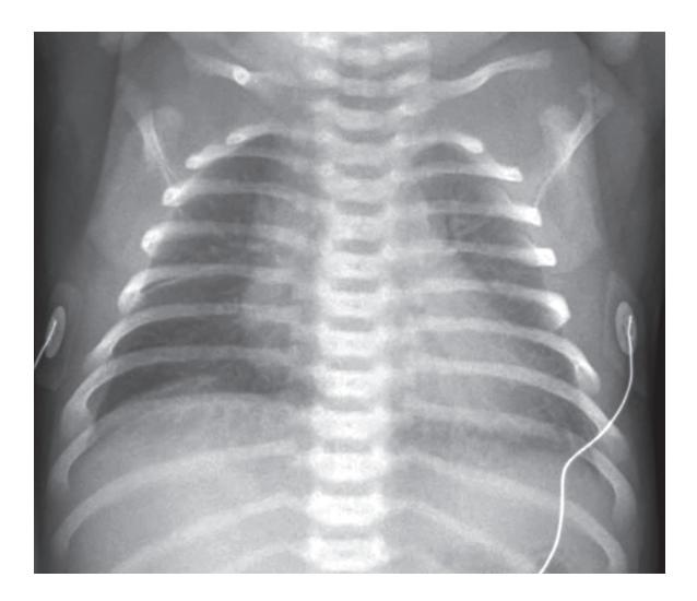 images/VVK-P-Osce 18. Radiology_page_14_Picture_8.jpeg